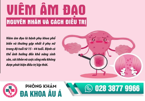 viêm âm đạo